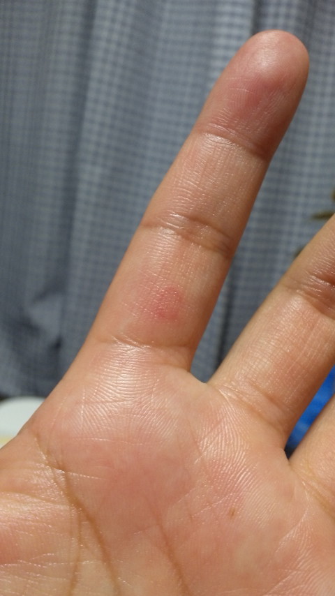 ������blog